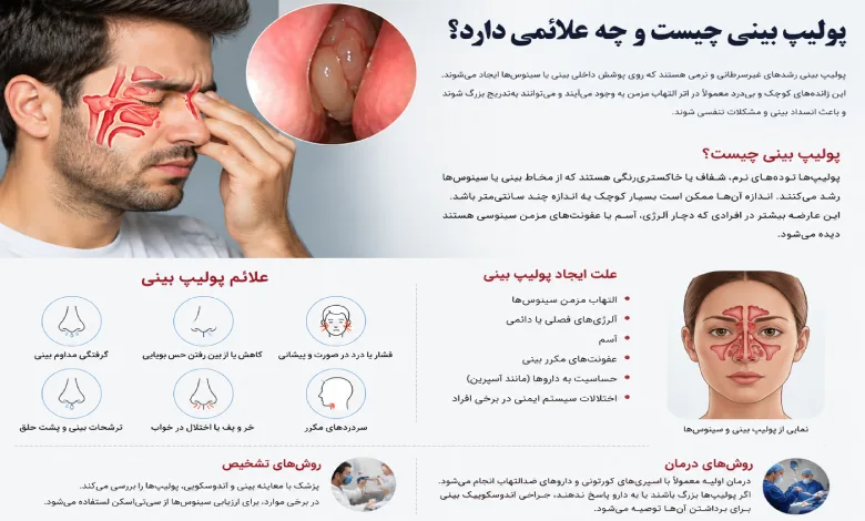 علت ایجاد پولیپ بینی چیست؟