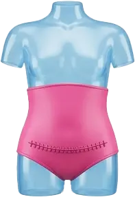 ابدومینوپلاستی کامل