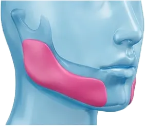 زاویه سازی با پروتز فک