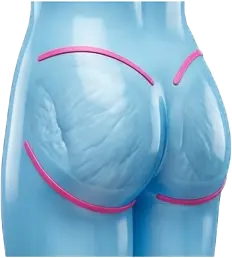 لیفت باسن