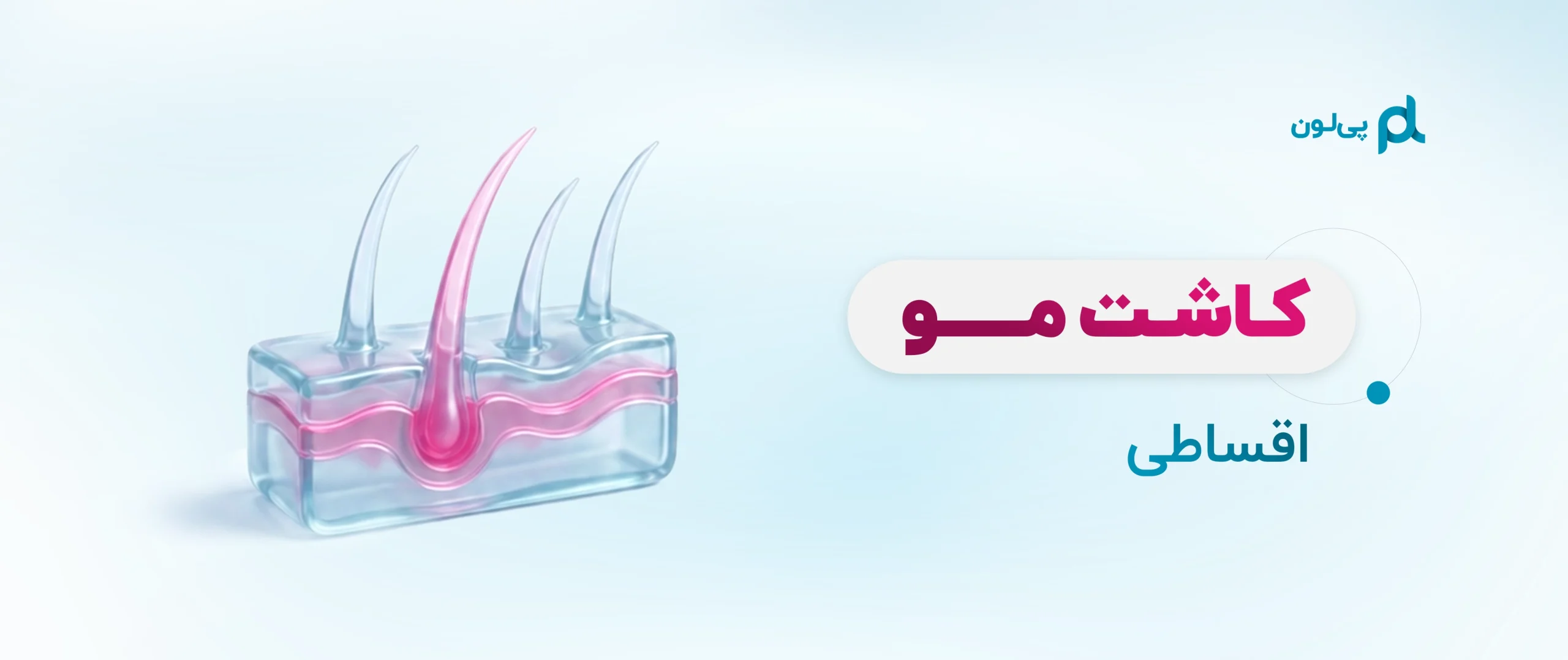 کاشت مو اقساطی